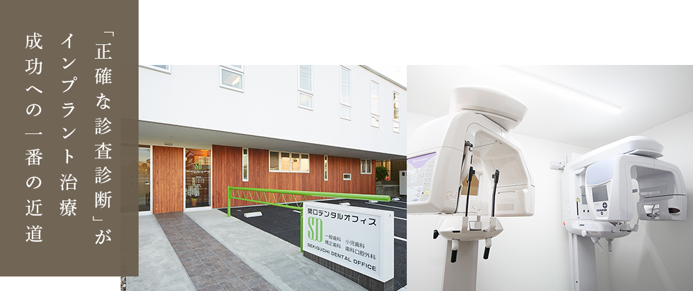 「正確な診査診断」がインプラント治療成功への一番の近道