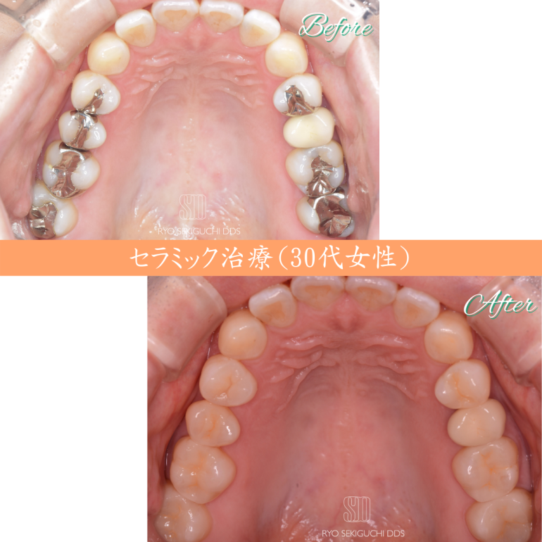 症例48