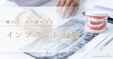 噛む力、次の歯を守るインプラント治療