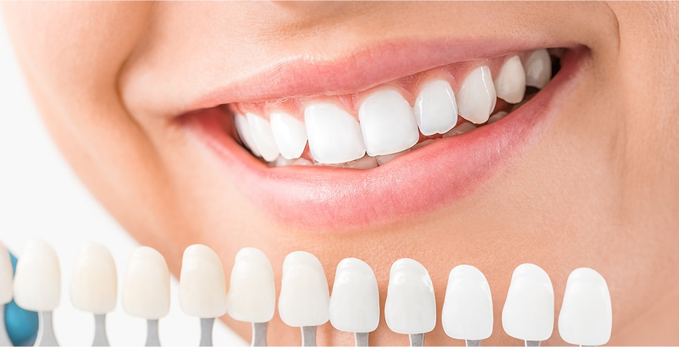 歯の黄ばみが気になる方ホワイトニングにも対応