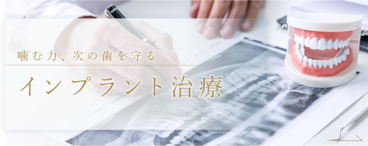 噛む力、次の歯を守るインプラント治療